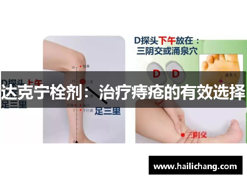 达克宁栓剂：治疗痔疮的有效选择